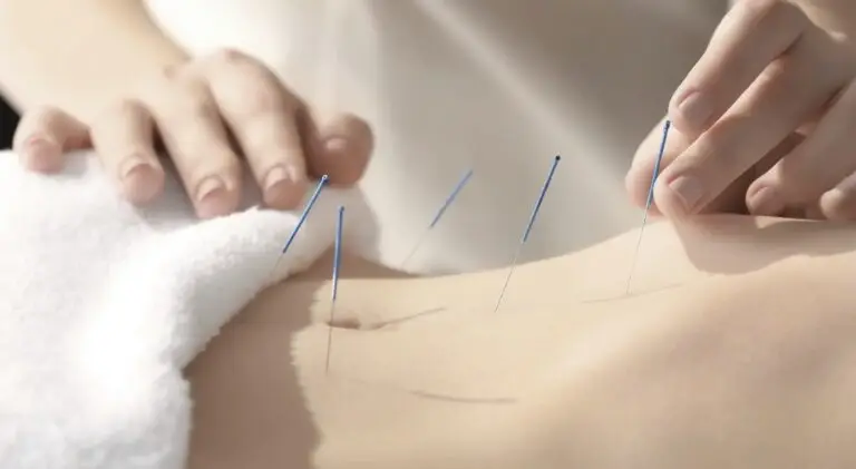 Acupuncture for Stress and Anxiety in Chicago